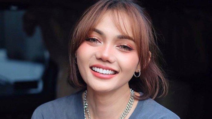 Kabar Rina Nose Yang Selalu Di Nanti Penggemarnya