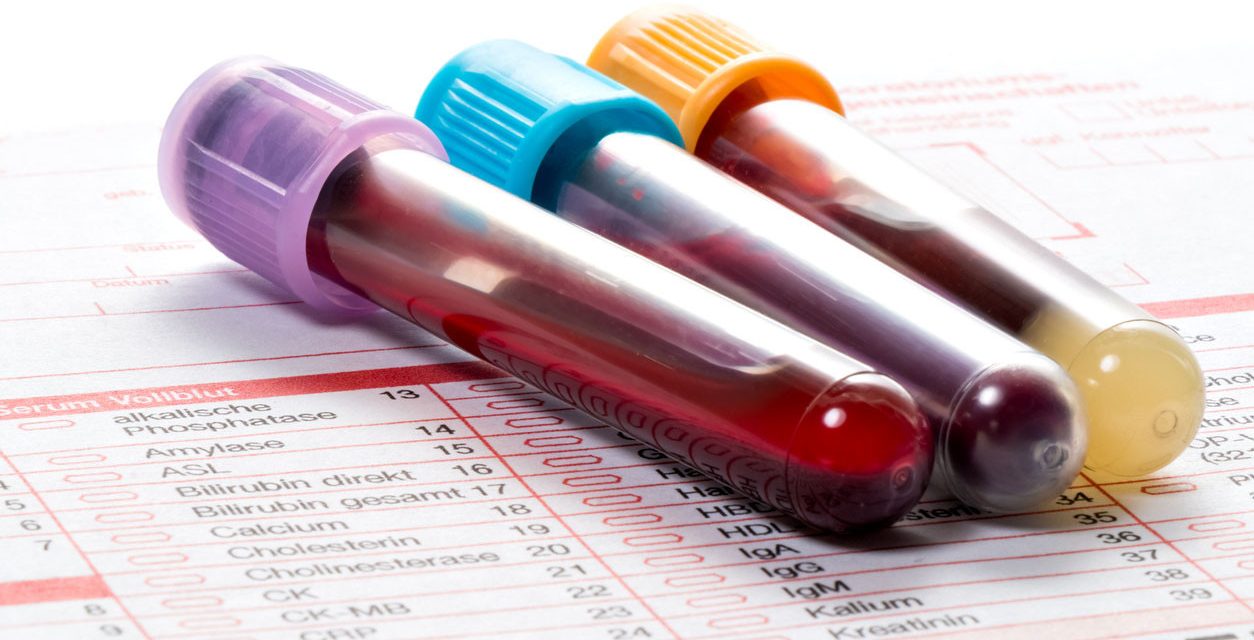Hemoglobin Darah Terlalu Tinggi Juga Berbahaya