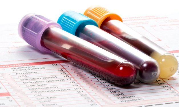 Hemoglobin Darah Terlalu Tinggi Juga Berbahaya