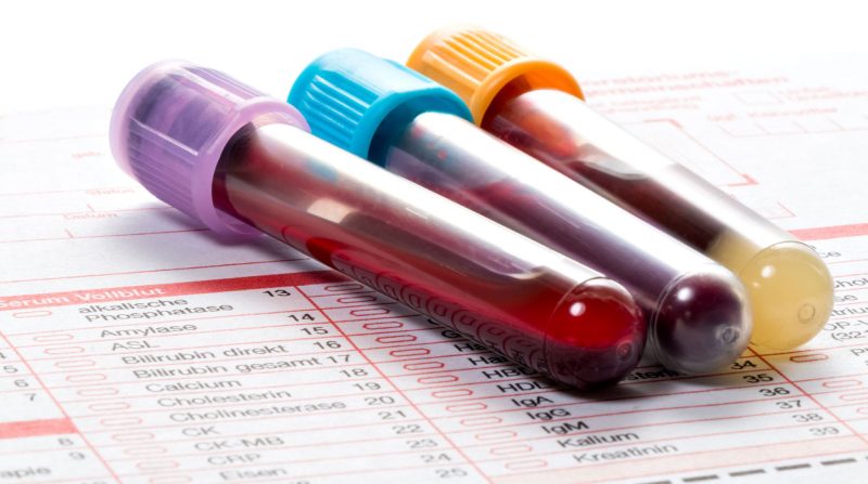 Hemoglobin Darah